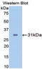 Carbonic Anhydrase 2 antibody, LS-C292389, Lifespan Biosciences, Western Blot image 