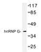 RNA Binding Motif Protein X-Linked antibody, AP20416PU-N, Origene, Western Blot image 