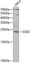 SSX Family Member 2B antibody, 22-611, ProSci, Western Blot image 