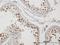 TRNA Methyltransferase 1 Like antibody, H00081627-B01P, Novus Biologicals, Immunohistochemistry paraffin image 
