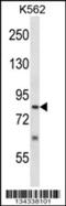 SUMO Specific Peptidase 5 antibody, 57-708, ProSci, Western Blot image 