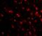 Tau Tubulin Kinase 1 antibody, GTX85349, GeneTex, Immunohistochemistry paraffin image 