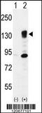 Integrin Subunit Alpha 5 antibody, MBS9209084, MyBioSource, Western Blot image 