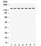 Structural Maintenance Of Chromosomes 3 antibody, R32356, NSJ Bioreagents, Western Blot image 