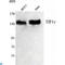 Tripartite Motif Containing 33 antibody, LS-C813136, Lifespan Biosciences, Western Blot image 