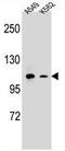 CD11b antibody, AP50837PU-N, Origene, Western Blot image 