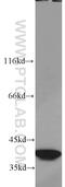 Survival Of Motor Neuron 2, Centromeric antibody, 22329-1-AP, Proteintech Group, Western Blot image 