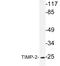 TIMP Metallopeptidase Inhibitor 2 antibody, LS-C176247, Lifespan Biosciences, Western Blot image 