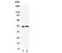 Leupaxin antibody, R31317, NSJ Bioreagents, Western Blot image 