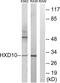 Homeobox D10 antibody, LS-C199074, Lifespan Biosciences, Western Blot image 