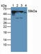 Keratin 10 antibody, LS-C294991, Lifespan Biosciences, Western Blot image 