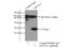 Eukaryotic Translation Initiation Factor 5A2 antibody, 17069-1-AP, Proteintech Group, Immunoprecipitation image 