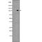 Leucine Rich Repeat Containing G Protein-Coupled Receptor 4 antibody, PA5-67868, Invitrogen Antibodies, Western Blot image 