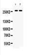 ATP Binding Cassette Subfamily A Member 4 antibody, PA5-78688, Invitrogen Antibodies, Western Blot image 