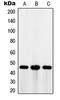 MAGE Family Member A1 antibody, LS-B16893, Lifespan Biosciences, Western Blot image 