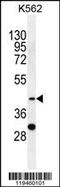 Serpin Family B Member 4 antibody, 55-921, ProSci, Western Blot image 