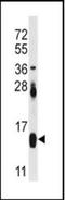 Fatty Acid Binding Protein 4 antibody, orb89516, Biorbyt, Western Blot image 