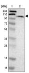 Lon Peptidase 2, Peroxisomal antibody, PA5-52618, Invitrogen Antibodies, Western Blot image 