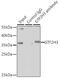 General Transcription Factor IIH Subunit 3 antibody, 22-768, ProSci, Immunoprecipitation image 