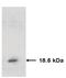 TIMP Metallopeptidase Inhibitor 2 antibody, orb109163, Biorbyt, Western Blot image 