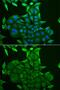 CD84 Molecule antibody, GTX32506, GeneTex, Immunocytochemistry image 