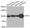 Aconitase 1 antibody, A6008, ABclonal Technology, Western Blot image 