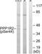 Protein phosphatase inhibitor 2 antibody, TA314371, Origene, Western Blot image 