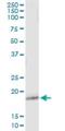 Epididymal secretory glutathione peroxidase antibody, H00002880-M02, Novus Biologicals, Immunoprecipitation image 