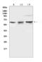 Elongator Acetyltransferase Complex Subunit 3 antibody, A02833-1, Boster Biological Technology, Western Blot image 