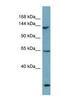 Large Tumor Suppressor Kinase 1 antibody, NBP1-58271, Novus Biologicals, Western Blot image 