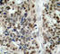 Forkhead Box O1 antibody, AP0172, ABclonal Technology, Immunohistochemistry paraffin image 