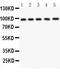 Nucleoporin 98 antibody, LS-C357488, Lifespan Biosciences, Western Blot image 