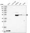 Beta-Secretase 2 antibody, HPA035416, Atlas Antibodies, Western Blot image 