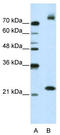 Frizzled Class Receptor 9 antibody, TA344067, Origene, Western Blot image 