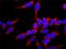 Fibroblast Growth Factor Receptor 1 antibody, GTX10646, GeneTex, Immunofluorescence image 