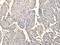 Serine Protease 38 antibody, PA5-51199, Invitrogen Antibodies, Immunohistochemistry paraffin image 