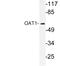 Solute Carrier Family 22 Member 6 antibody, LS-C291714, Lifespan Biosciences, Western Blot image 