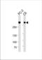 Filamin A antibody, TA328181, Origene, Western Blot image 