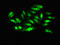 MRE11 Homolog, Double Strand Break Repair Nuclease antibody, LS-C678690, Lifespan Biosciences, Immunofluorescence image 