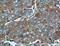 Protein Activator Of Interferon Induced Protein Kinase EIF2AK2 antibody, 10771-1-AP, Proteintech Group, Immunohistochemistry paraffin image 