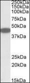 C-X-C Motif Chemokine Receptor 6 antibody, orb95146, Biorbyt, Western Blot image 