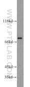 Fermitin Family Member 3 antibody, 18131-1-AP, Proteintech Group, Western Blot image 