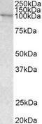 Vav Guanine Nucleotide Exchange Factor 3 antibody, GTX89695, GeneTex, Western Blot image 