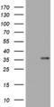 Zinc Finger CCHC-Type Containing 24 antibody, NBP2-45421, Novus Biologicals, Western Blot image 