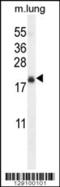 Transmembrane Protein 80 antibody, 56-230, ProSci, Western Blot image 