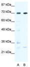 WRN Helicase Interacting Protein 1 antibody, TA341610, Origene, Western Blot image 