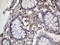 Metadherin antibody, LS-C338841, Lifespan Biosciences, Immunohistochemistry frozen image 