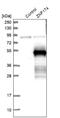 Zinc Finger Protein 174 antibody, NBP1-86821, Novus Biologicals, Western Blot image 
