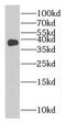 Methylenetetrahydrofolate Dehydrogenase (NADP+ Dependent) 2, Methenyltetrahydrofolate Cyclohydrolase antibody, FNab05403, FineTest, Western Blot image 