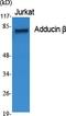 Adducin 2 antibody, A05106, Boster Biological Technology, Western Blot image 